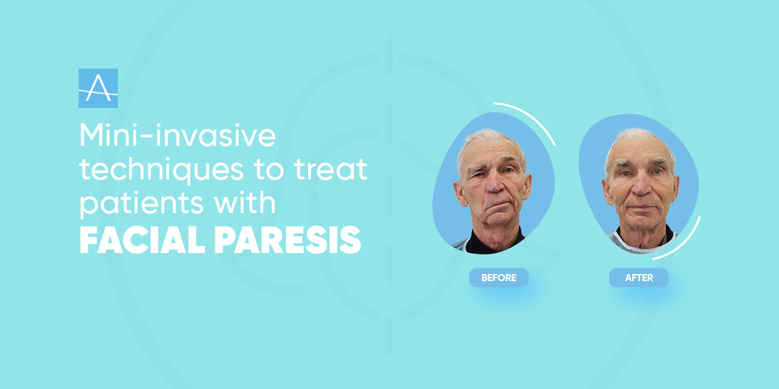 SOCIAL ASSISTANCE PROGRAM FOR PATIENTS WITH PARESIS OF THE MIMIC MUSCLES OF THE FACE